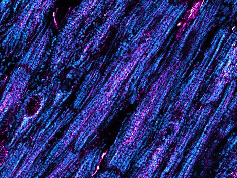  Microscopic image of heart muscle cells with bright blue and purple structures.