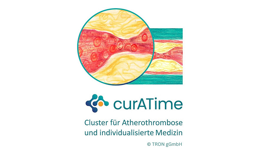 Illustration of a narrowed artery with deposits that impede blood flow. In the foreground is an enlarged view of the narrowing of the vessel, with the entire artery in the background. Below is the curATime logo with the words “Cluster for Atherothrombosis and Individualised Medicine”.