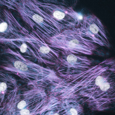 Microscopic image of muscle cells showing elongated, striated fibres in shades of purple with several bright white, oval nuclei.