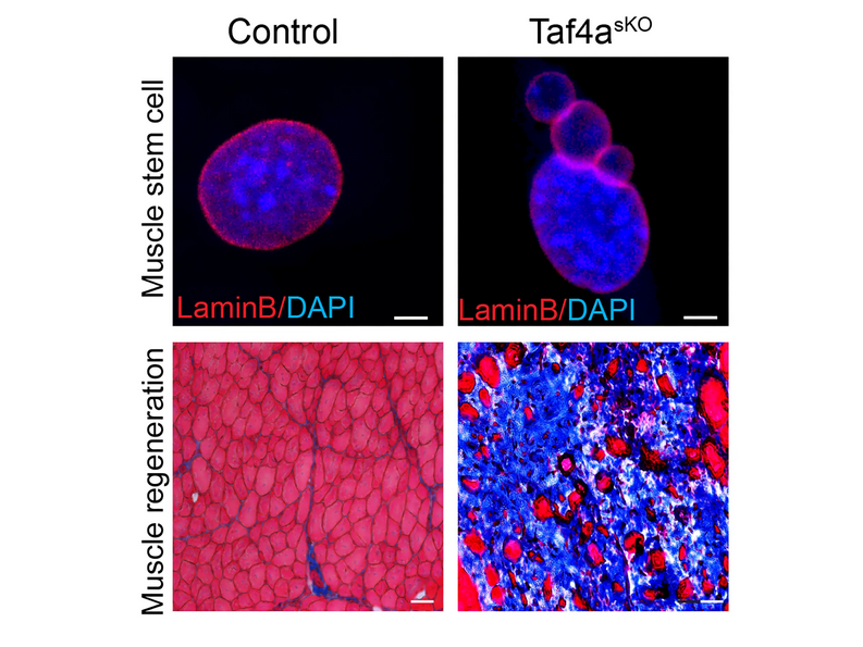 Fluorescence microscopy of muscle stem cells and regeneration.