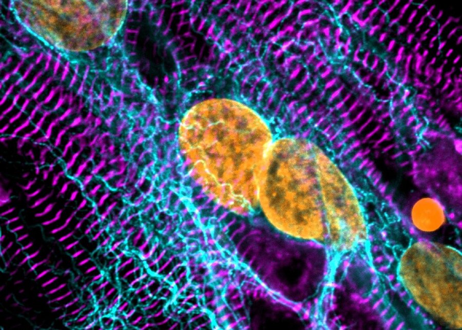  Induced pluripotent stem cell cardiomyocytes, stained for the sarcomeric protein ACTN2 (purple), detyrosinated microtubules (cyan) and DNA (orange), imaged with confocal microscopy at 63x magnification. 