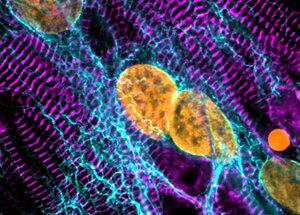  Induced pluripotent stem cell cardiomyocytes, stained for the sarcomeric protein ACTN2 (purple), detyrosinated microtubules (cyan) and DNA (orange), imaged with confocal microscopy at 63x magnification. 