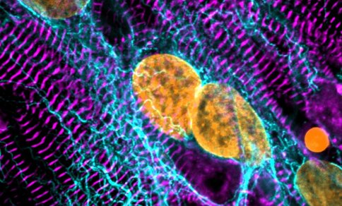  Induced pluripotent stem cell cardiomyocytes, stained for the sarcomeric protein ACTN2 (purple), detyrosinated microtubules (cyan) and DNA (orange), imaged with confocal microscopy at 63x magnification. 