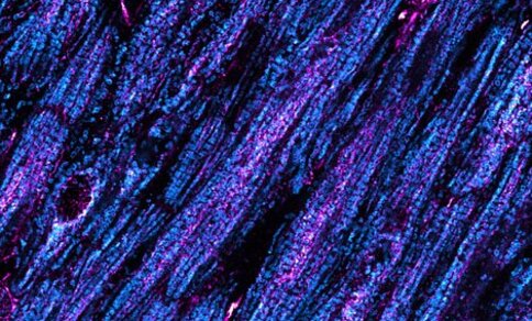  Microscopic image of heart muscle cells with bright blue and purple structures.