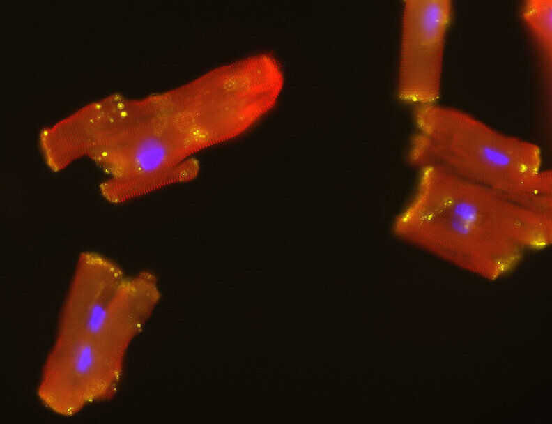 Nahaufnahme eines Mikroskops mit roten und blauen Lichtern, das isolierte humane Herzmuskelzellen zeigt.