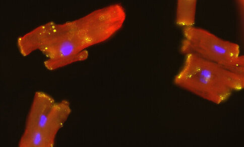 Close-up of a microscope with red and blue lights showing isolated human heart muscle cells.