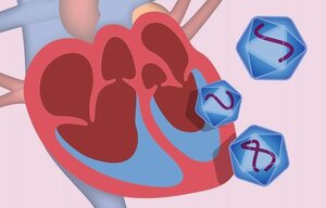 Gentherapie der kardialen Hypertrophie