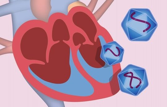 Gentherapie der kardialen Hypertrophie