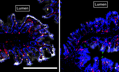 Microscopic image of two tissue samples from mice under fluorescent labelling. Cell nuclei are highlighted in blue, immune cells in red and yellow. The image contains white scale bars for size reference 