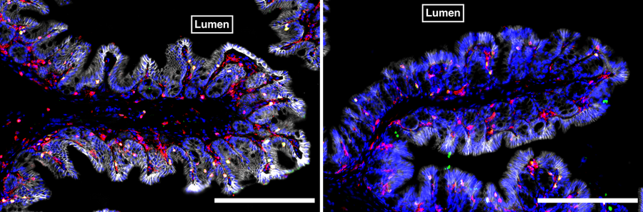 Microscopic image of two tissue samples from mice under fluorescent labelling. Cell nuclei are highlighted in blue, immune cells in red and yellow. The image contains white scale bars for size reference 