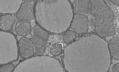 Images of mitochondria in brown adipose tissue using electron microscopy