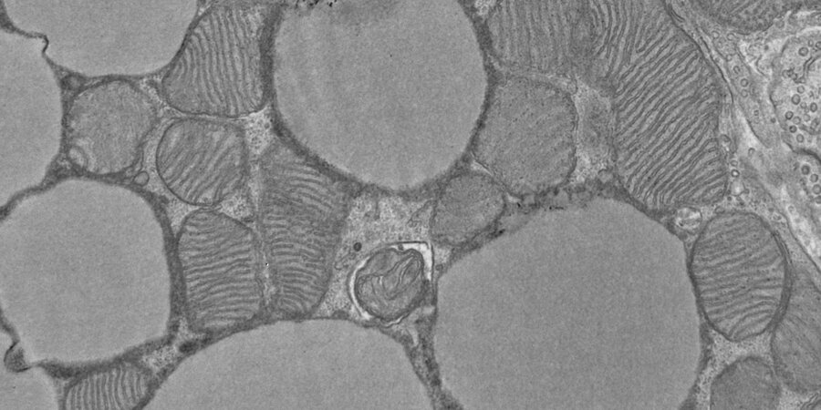 Images of mitochondria in brown adipose tissue using electron microscopy
