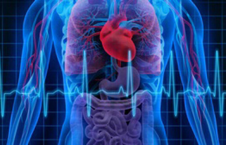 Immediate unselected coronary angiography versus delayed triage in survivors of out-of-hospital cardiac arrest without ST-segment elevation (TOMAHAWK-DZHK4)
