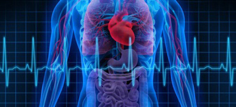 TOMAHAWK-DZHK4 - Immediate unselected coronary angiography versus delayed triage in survivors of out-of-hospital cardiac arrest without ST-segment elevation (TOMAHAWK-DZHK4)