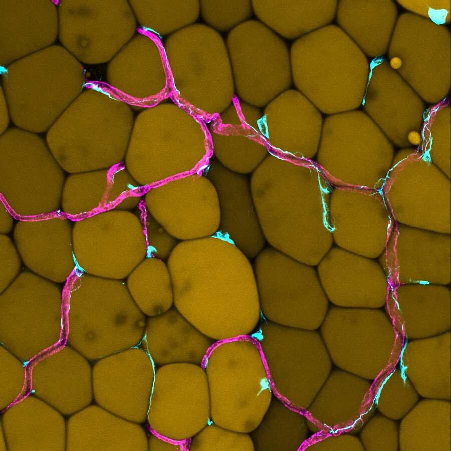 Microscope image of fatty tissue with yellow fat cells and pink-blue blood vessels in between.