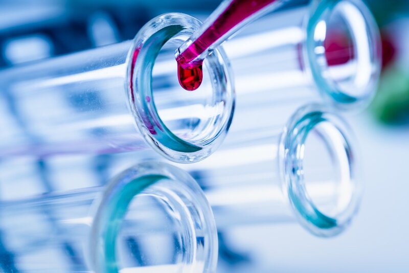  - Proteom-Analyse des neuen Biomarkers CCN1 in der Erkrankung und Vorhersage von Todesfällen bei Patienten mit Dilatativer Kardiomyopathie