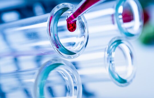 Proteom-Analyse des neuen Biomarkers CCN1 in der Erkrankung und Vorhersage von Todesfällen bei Patienten mit Dilatativer Kardiomyopathie