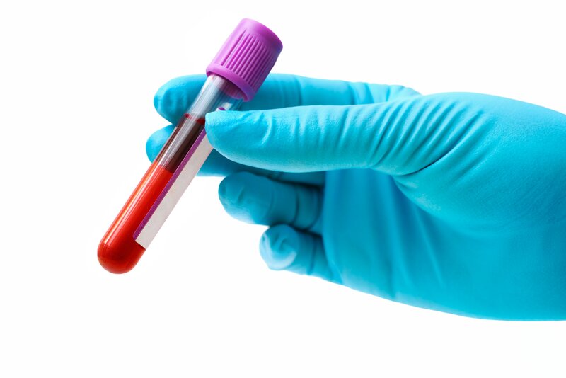  - Characterization of lipidome dynamics in anthracycline-induced cardiotoxicity