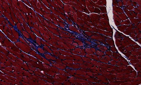 Microscopic image of stained mouse heart tissue showing pink to purple cardiac muscle cells in sections where the cell bundles and cell boundaries are clearly defined and dark cell nuclei stand out as small dots.