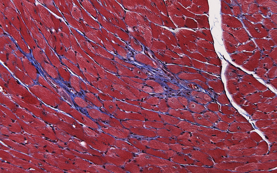 Microscopic image of stained mouse heart tissue showing pink to purple cardiac muscle cells in sections where the cell bundles and cell boundaries are clearly defined and dark cell nuclei stand out as small dots.