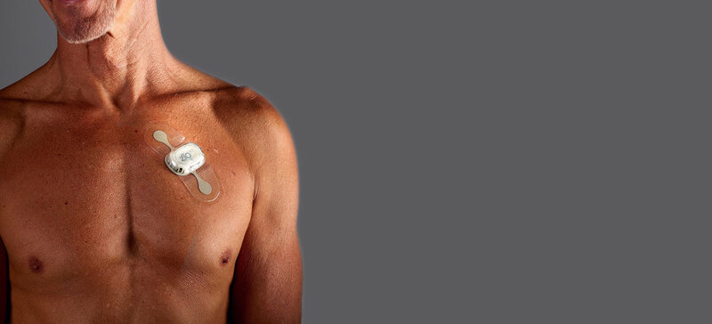 SCREEN AF-DZHK15 - Home-Based Screening for Early Detection of Atrial Fibrillation in Primary Care Patients Aged 75 Years and Older (SCREEN AF-DZHK15)