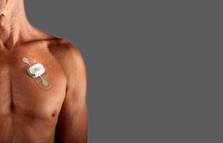 Home-Based Screening for Early Detection of Atrial Fibrillation in Primary Care Patients Aged 75 Years and Older (SCREEN AF-DZHK15)