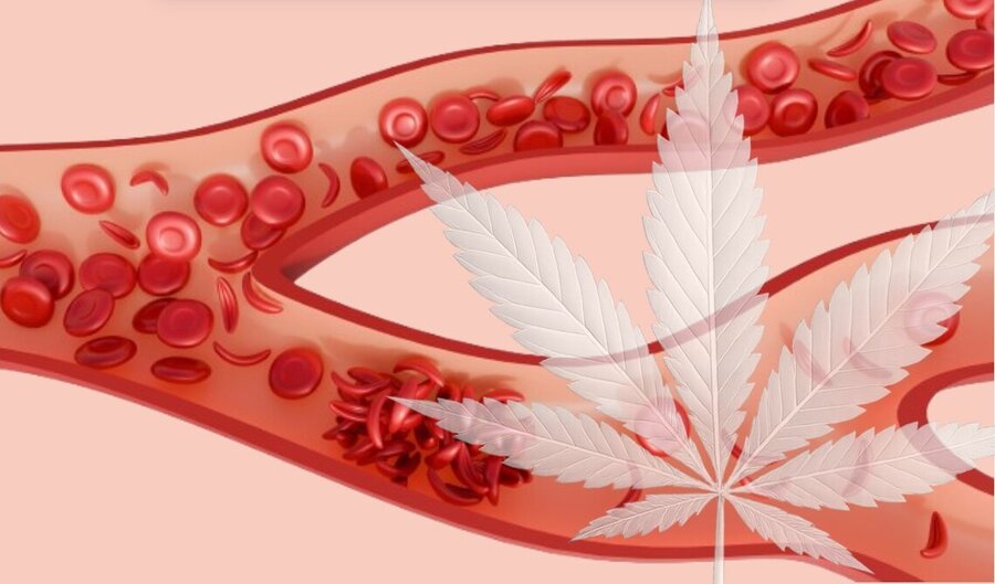 Illustration of a blood vessel with flowing red blood cells and deposits along the vessel wall, overlaid with a large, semi-transparent cannabis leaf.