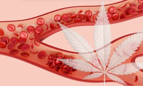 Illustration of a blood vessel with flowing red blood cells and deposits along the vessel wall, overlaid with a large, semi-transparent cannabis leaf.
