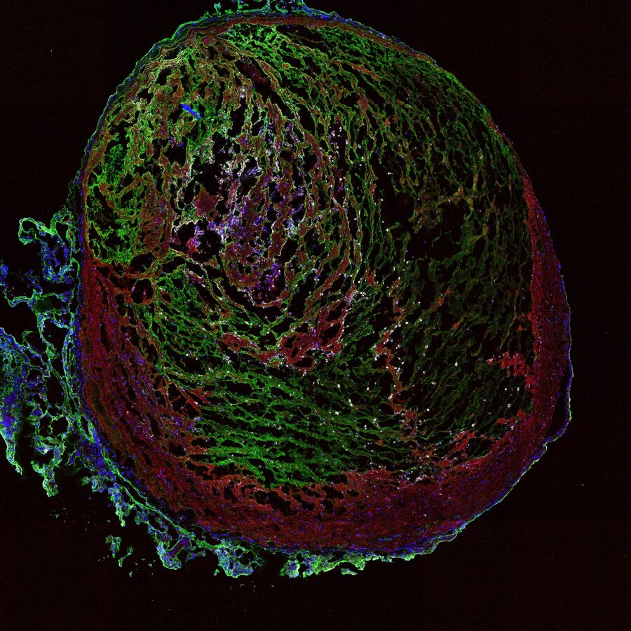 Fluorescence microscope image of a thrombus from the vein of a mouse. The different colours indicate different cell structures, while white dots indicate procoagulant platelets, which were analysed in the study. 