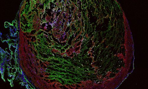 Fluorescence microscope image of a thrombus from the vein of a mouse. The different colours indicate different cell structures, while white dots indicate procoagulant platelets, which were analysed in the study. 