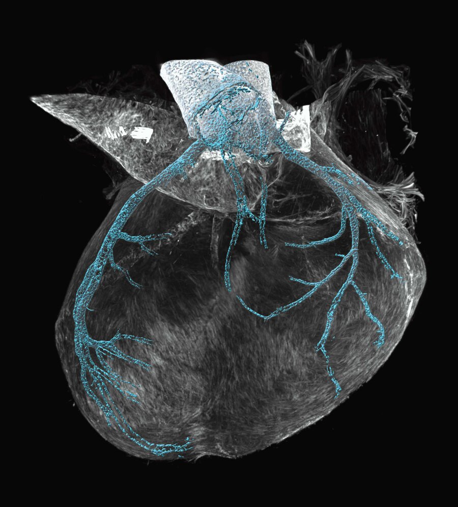 Heart of a mouse in late embryonic stage with transparent tissue, visible developing coronary arteries in turquoise colour