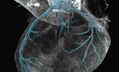 Heart of a mouse in late embryonic stage with transparent tissue, visible developing coronary arteries in turquoise colour
