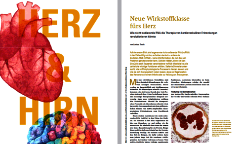 Picture of heart and brain with the title ‘New therapy for the heart’ from the Frankfurter Forschung Magazin.