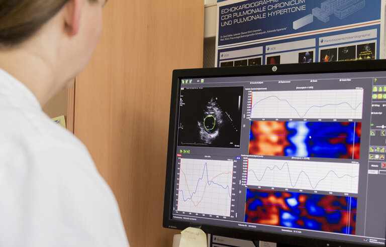 Ultrasound evaluation of the inferior vena cava in addition to clinical assessment to guide decongestion in acute decompensated heart failure: a pilot study (CAVA-ADHF-DZHK10)
