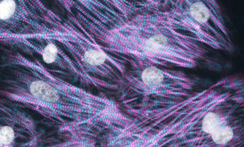 Mikroskopische Aufnahme von Muskelzellen, die längliche, gestreifte Fasern in Violetttönen mit mehreren hellweißen, ovalen Kernen zeigen.