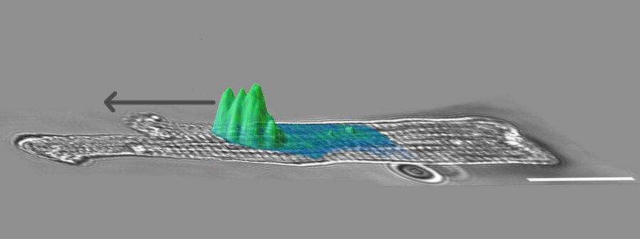  Microscopic image of an atrial muscle cell. The cell shows a region highlighted in green, which presumably represents a calcium wave, and another blue marker in the cell structure. The background is grey. 