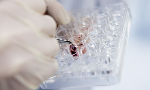 Close-up of a gloved hand using tweezers to handle a tissue sample in a laboratory multiwell plate
