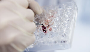 Close-up of a gloved hand using tweezers to handle a tissue sample in a laboratory multiwell plate