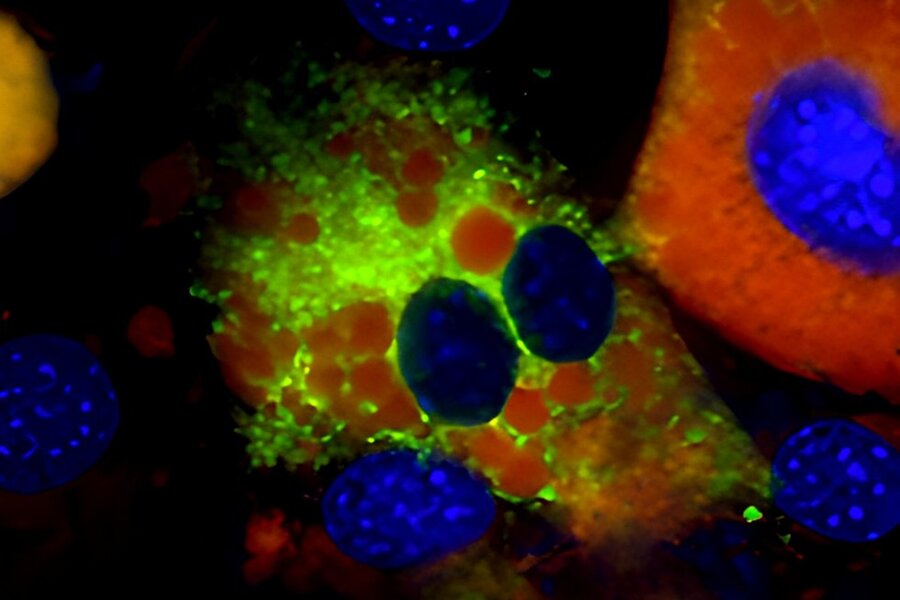 A microscopic image of a cell shows how it succumbs to ferroptosis, or cell death. 