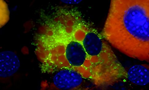 A microscopic image of a cell shows how it succumbs to ferroptosis, or cell death. 