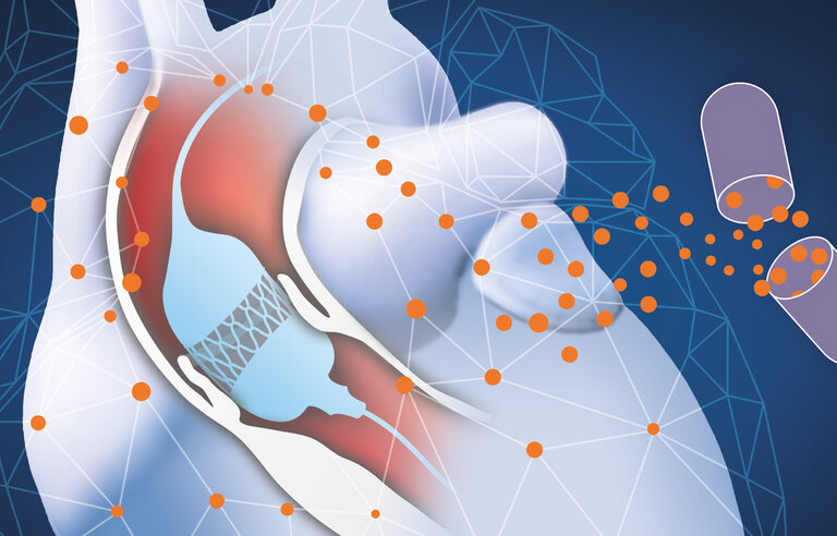 Effect of anti-fibrotic therapy on regression of myocardial fibrosis after transcatheter aortic valve implantation (TAVI) in aortic stenosis patients with high fibrotic burden (Reduce-MFA-DZHK25)