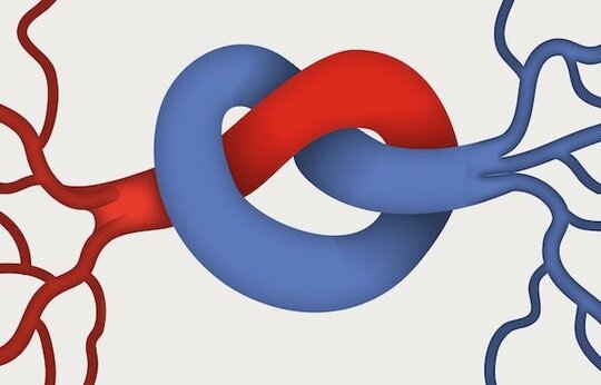 rAAV.MRTF-A-basierte vaskuläre Gentherapie bei der chronischen Ischämie der Extremitäten