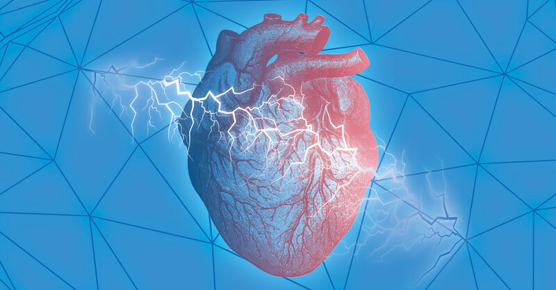 CMR-ICD-DZHK23 - Cardiac Magnetic Resonance guidance of Implantable Cardioverter Defibrillator implantation in non-ischaemic dilated cardiomyopathy (CMR-ICD-DZHK23)