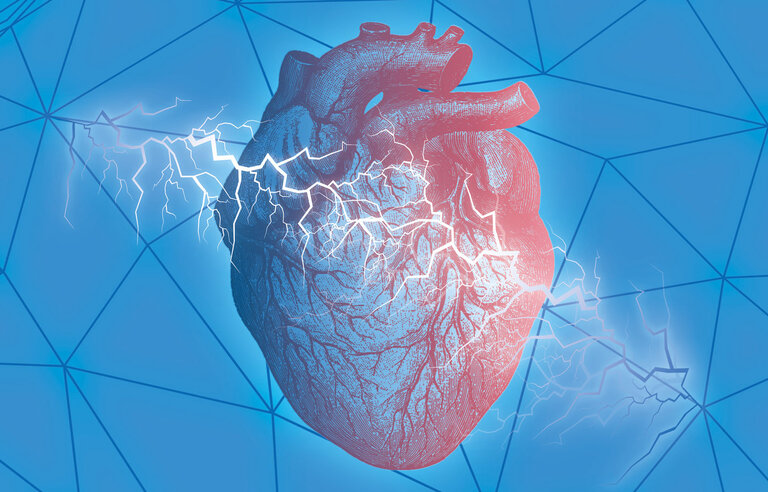 Cardiac Magnetic Resonance guidance of Implantable Cardioverter Defibrillator implantation in non-ischaemic dilated cardiomyopathy (CMR-ICD-DZHK23)
