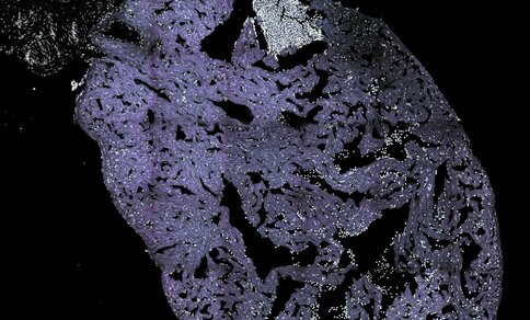 A tissue structure with numerous cavities and channels against a black background. The surface appears porous and openwork. In the upper section, there is a smaller, lighter-coloured area with irregular edges.