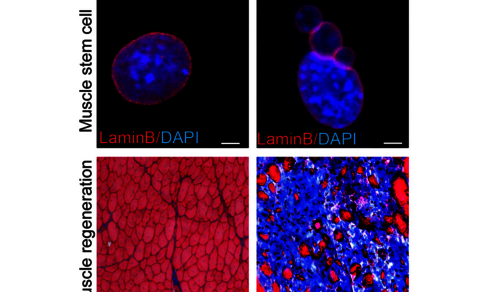 Fluoreszenzmikroskopie von Muskelstammzellen und Regeneration.