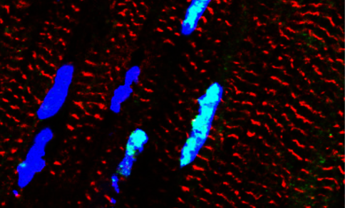 Fluorescence microscope image showing elongated red structures and several blue-glowing oval shapes against a dark background.