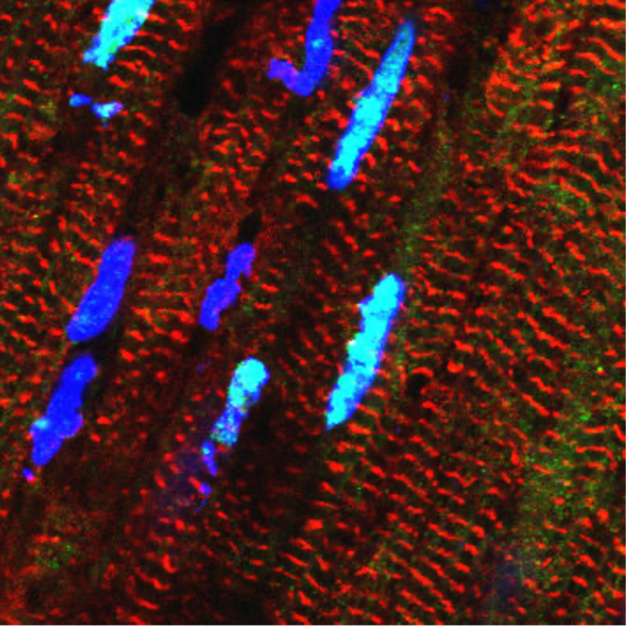 Fluorescence microscope image showing elongated red structures and several blue-glowing oval shapes against a dark background.