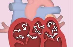 Niedrig-Energie-Defibrillation von Kammer-flimmern in Schweinen als Tiermodell für die Herzinsuffizienz