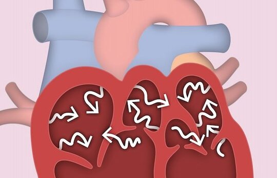 Niedrig-Energie-Defibrillation von Kammer-flimmern in Schweinen als Tiermodell für die Herzinsuffizienz